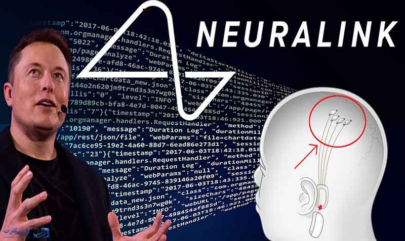 Neuralink چیست